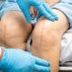 Break Up Scar Tissue To Heal Knee Replacement